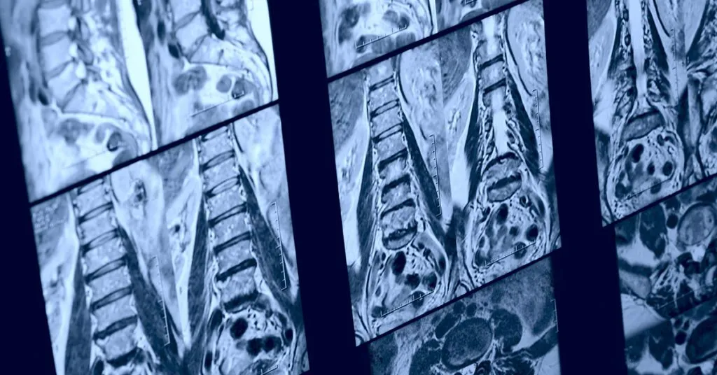 Back Mri 1024X536 1