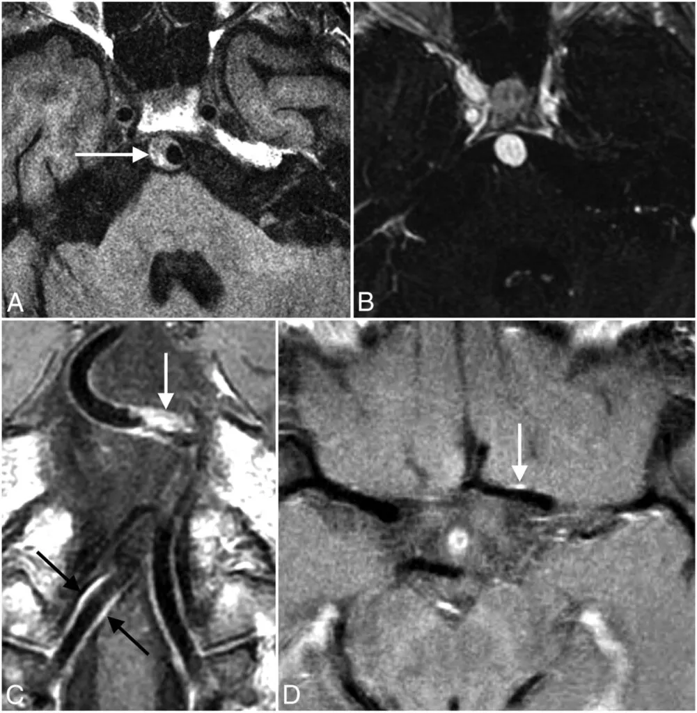 How often should someone get an MRI for health monitoring?