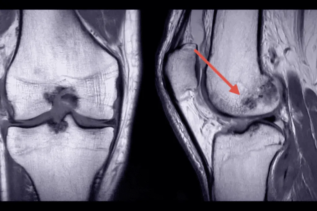 Joint and Bone Problems mri