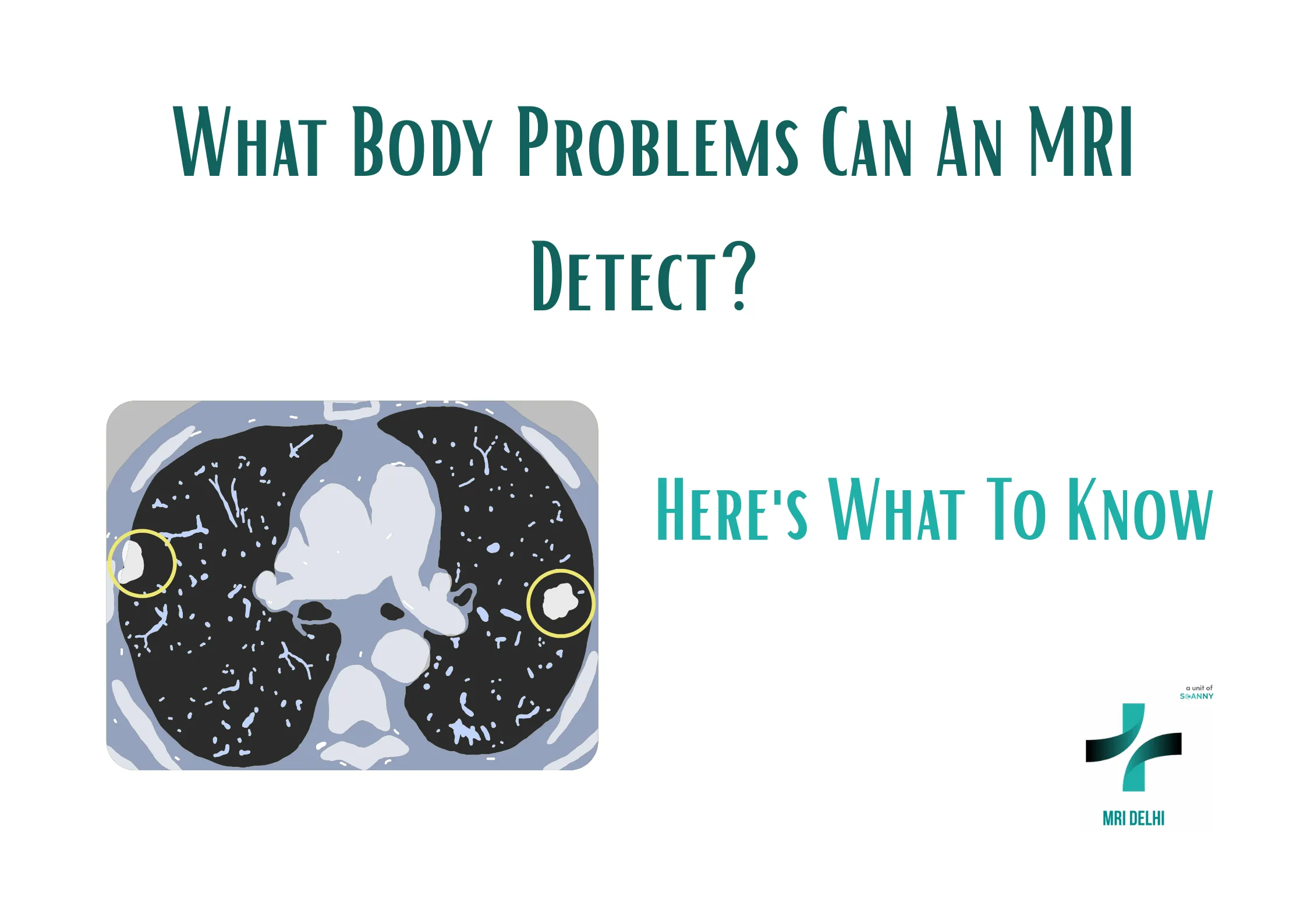 What Body Problems Can An MRI Detect